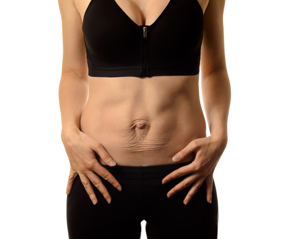 BIOESTIMULADOR DE COLÁGENO